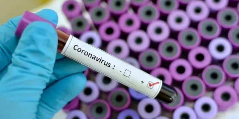Los contagiados por COVID-19 podrían curarse con transfusiones de plasma.