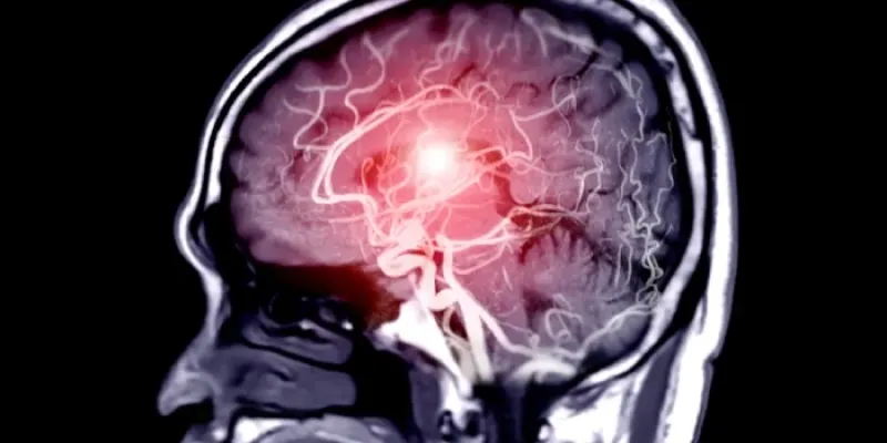 Una resonancia magnética de un cerebro humano.