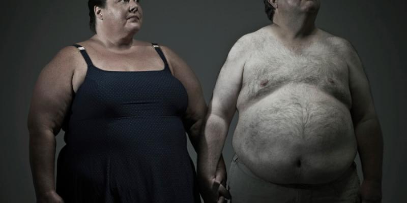 Obesidad