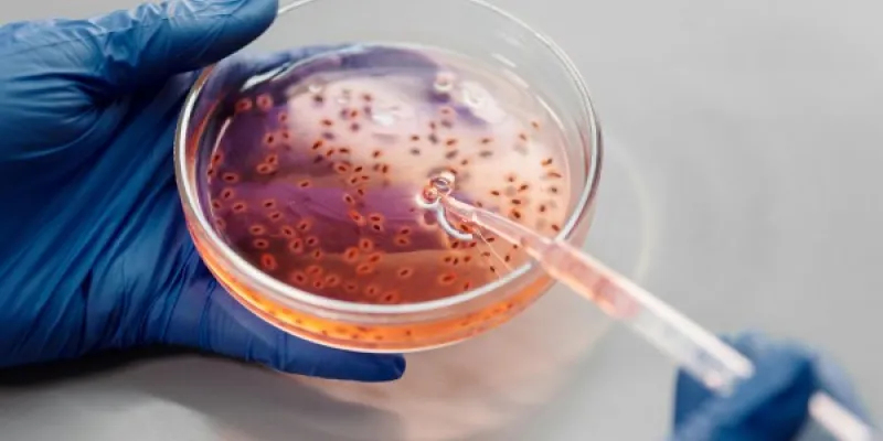 La resistencia antimicrobiana es preocupante