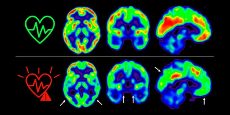 Cuidar tu salud cerebral, consejos