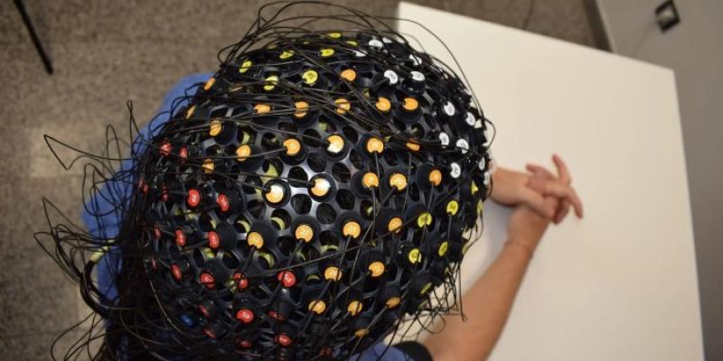 Prototipo del 'gorro de piscina' en humanos. 