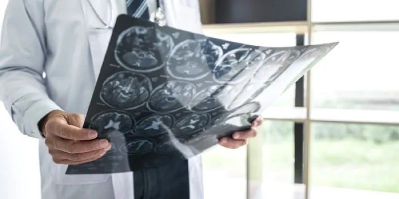 Un médico sostiene en sus manos una radiografía del cerebro