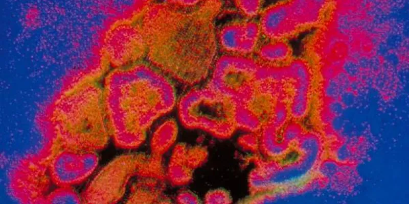 Virus de Marbugo