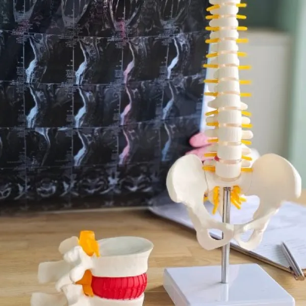 Un doctor examina imágenes tomográficas de una columna dañada