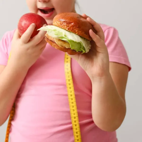 Un estudio resalta la obesidad infantil