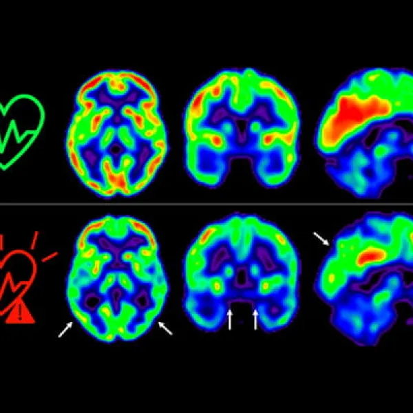 Cuidar tu salud cerebral, consejos