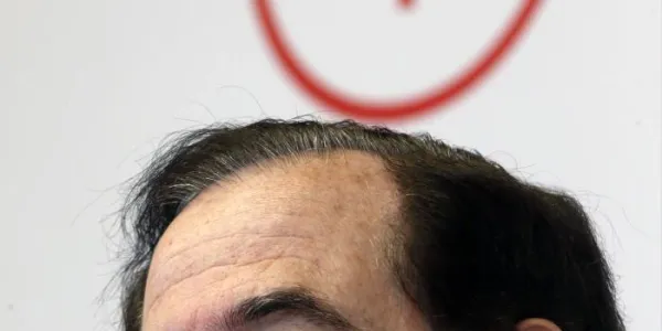 15144977w