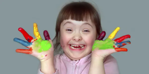 Niña con Síndrome de Down