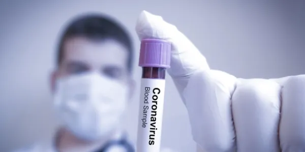 Año perdido por la crisis del coronavirus