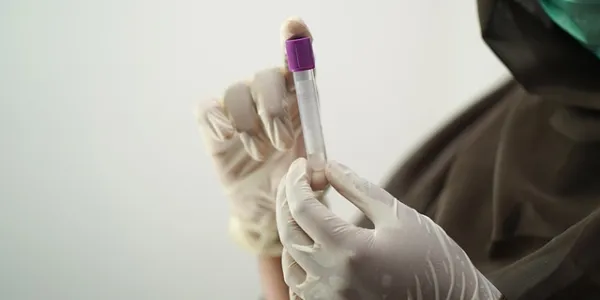 Científico con un tubo de análisis de sangre