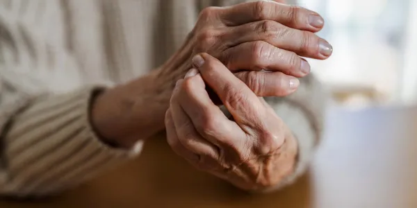 Nuevos tratamientos para la artritis reumatoide