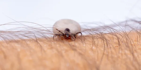 Una garrapata 'Ixodes ricinus' anclada a la piel humana