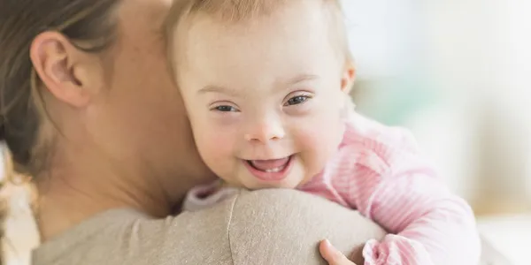 Bebé con síndrome de Down