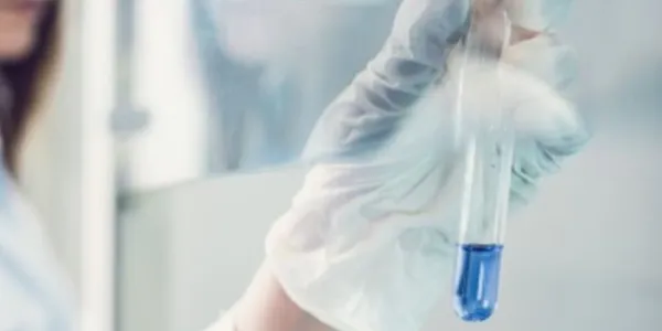 Manos de una mujer científica con un tubo de ensayo