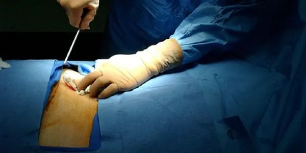 Imagen de Cirugía, Operación y Hospital. De uso gratuito.