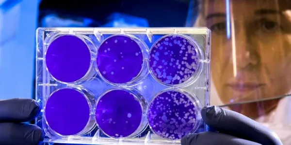 Pruebas científicas con coronavirus. (Foto. Rawpixel)