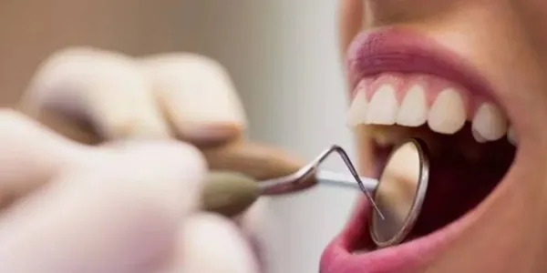Los españoles no acuden al dentista