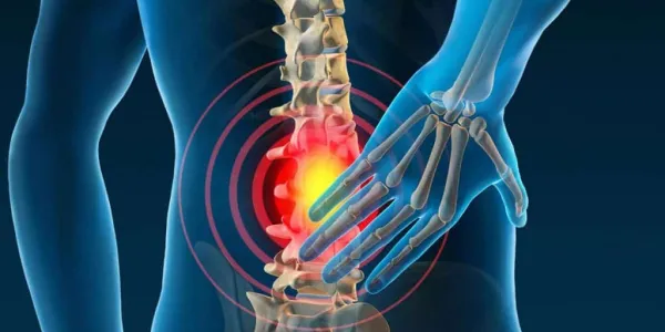 Tratamientos no quirúrgicos ni invasivos para el dolor lumbar