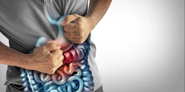 Avances en la Enfermedad de Crohn