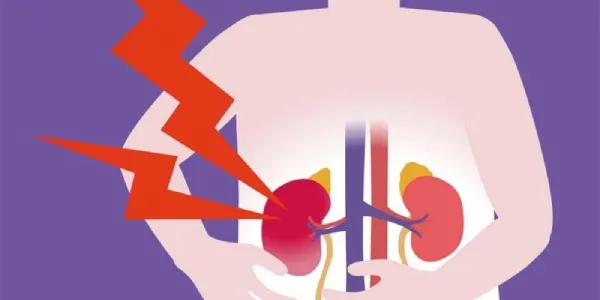 Ilustracion de un paciente con enfermedad renal