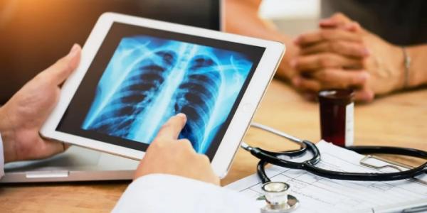 cáncer de pulmón - Foto: Prapass Pulsub cáncer de pulmón