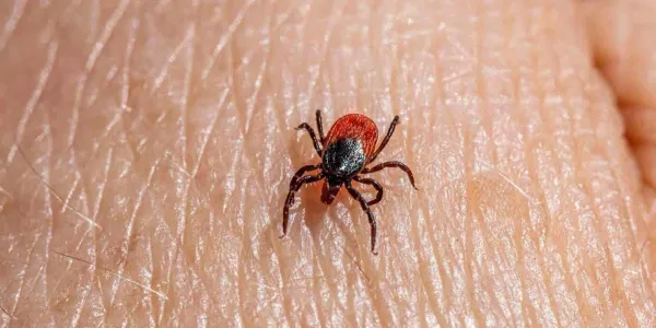 Fiebre por las garrapatas
