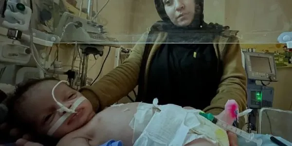 Una madre cuida en el hospital Al-Aqsa a su bebé, muy grave y amputado