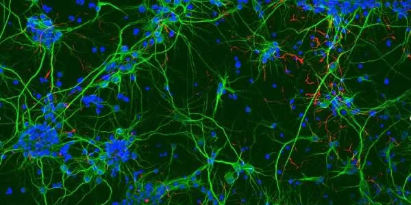 Lesiones medulares