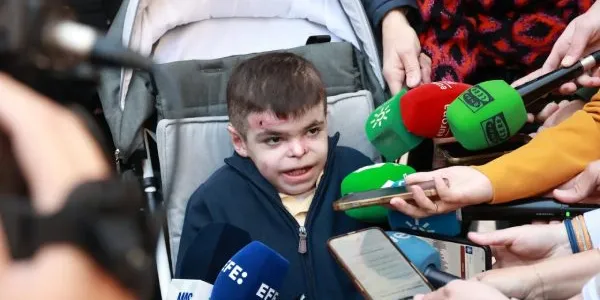 Leo García, el niño de 12 años andaluz que tiene piel de mariposa