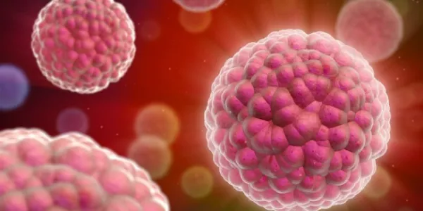 El linfoma de Hodgkin es un tipo de cáncer de sangre