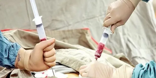 La donación de médula ósea sigue enfrentando un desafío clave