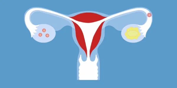 Menstruación