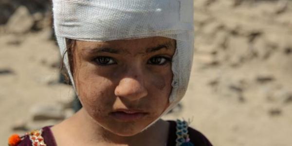 Una niña herida tras bombardeos aéreos pakistaníes en Kabul, Afganistán, el 14 de marzo de 2026.