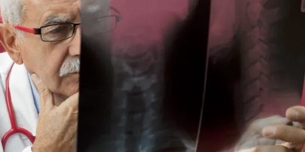 Un neurocirujano estudia una radiografía de columna lumbar