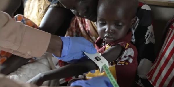 Un bebé es evaluado para su vacunación en Sudán del Sur