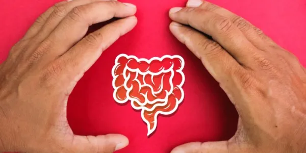 cáncer de colon