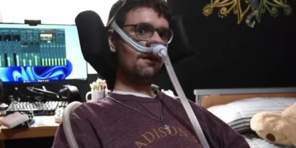 Un paciente con respiración asistida