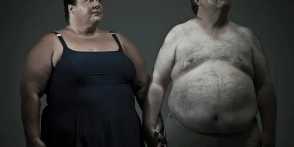 Obesidad