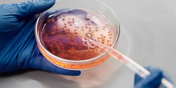 La resistencia antimicrobiana es preocupante