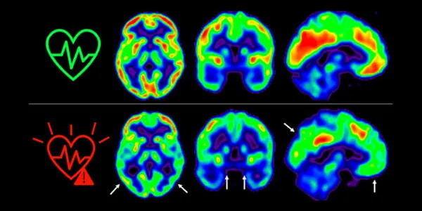 Cuidar tu salud cerebral, consejos