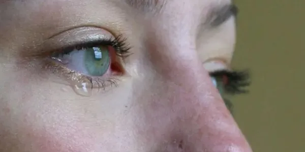 Ojos de una mujer con problemas de salud mental