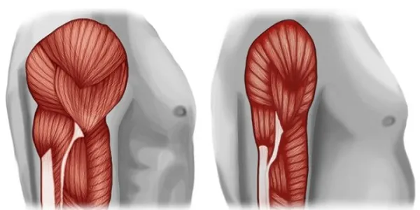 Sarcopenia, afección en los músculos