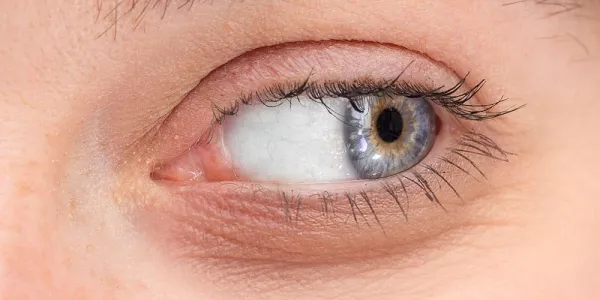 Ojo de una persona