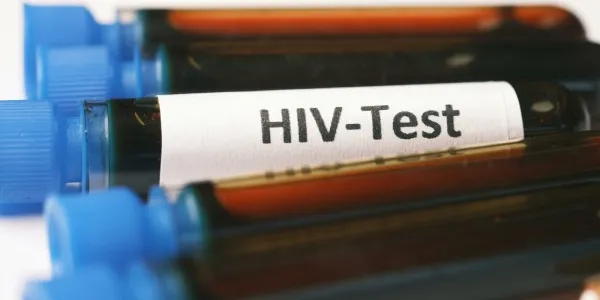 Tubos análisis de sangre con etiqueta que dice: VIH test