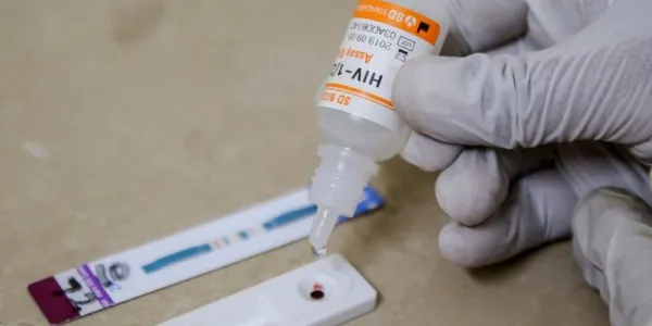 Un técnico de laboratorio realiza una prueba de detección del VIH en un centro médico de Hayatabad, en el distrito de Peshawar (Pakistán).