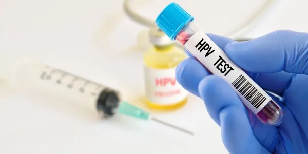 Prevención del VPH